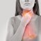 Do you suffer from heartburn? Try CBD