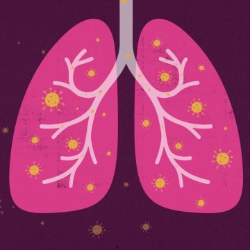 THC nella Cannabis Medica: Potenziale Terapeutico per l'ARDS