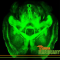 Treatment of Neurodegenerative Disorders Using Cannabis