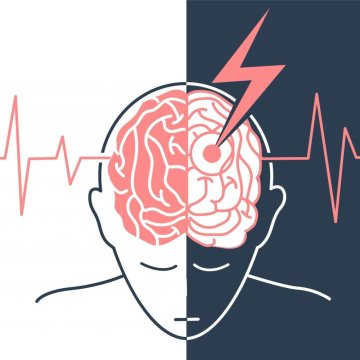 CBD bei der Behandlung von Schlaganfall: Welche Vorteile bietet es?