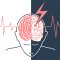 CBD in Stroke Treatment: What Benefits Does It Offer?