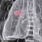 When can cannabis complicate cancer treatment?