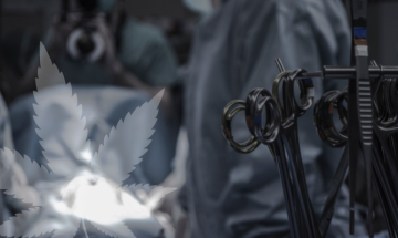 Ist es sicher, Cannabis vor und nach einer Operation einzunehmen? Was sagen die Experten?