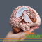 "Cannabis healed my head"