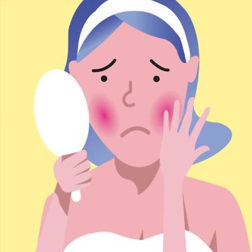 Rosacea a CBD: Může kanabidiol pomoci s růžovkou?