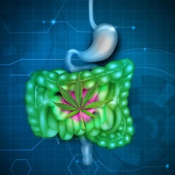 CBD pri liečbe kolitídy a Crohnovej choroby